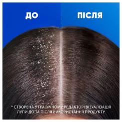 Шампунь Head & Shoulders Против перхоти Глубокое увлажнение 250 мл Фото 1